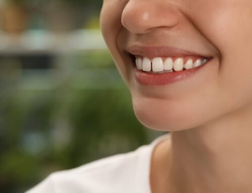 Diastema: La moda de los dientes separados.